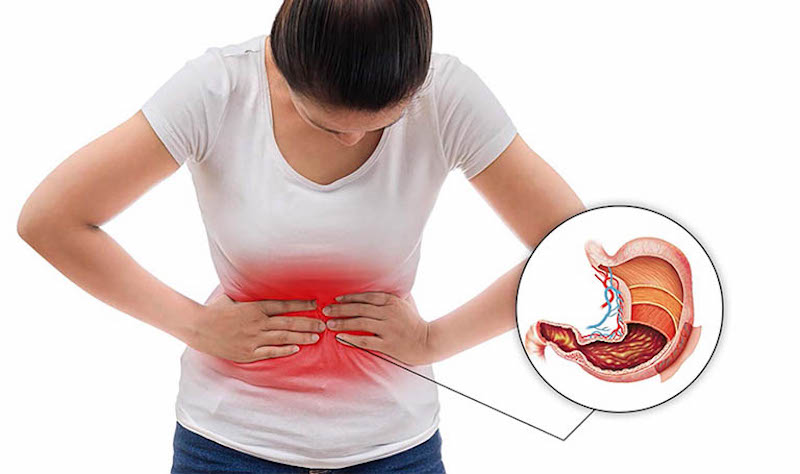 nghệ đen điều trị đau dạ dày